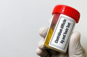 What Kills C Diff Other Than Bleach?